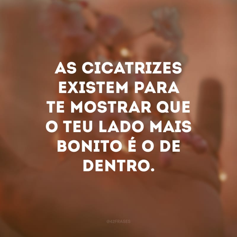 As cicatrizes existem para te mostrar que o teu lado mais bonito é o de dentro.