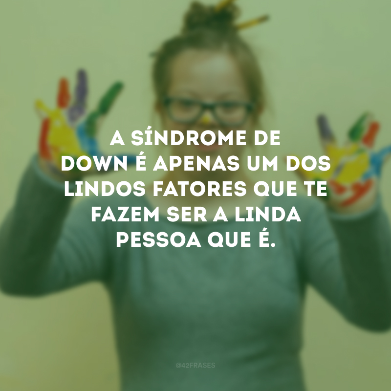 A Síndrome de Down é apenas um dos lindos fatores que te fazem ser a linda pessoa que é.